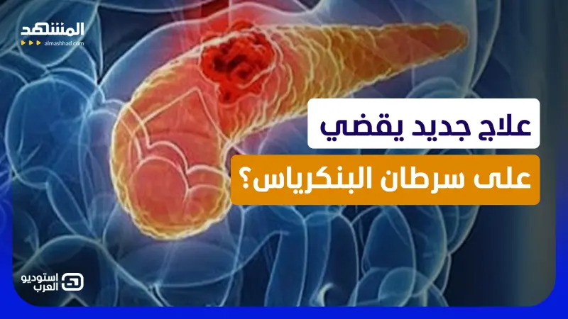 news_suggested_videos_ثورة علمية.. دواء معجزة يقضي على سرطان البنكرياس؟ 